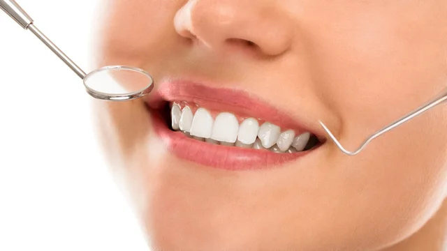Real Clinical Dental Examination with Mirror and Probe at NGM Dental Clinic