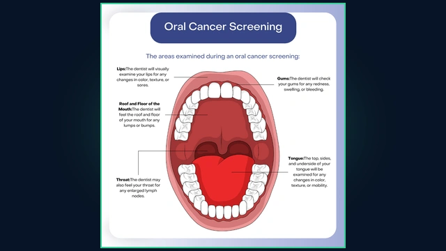 Oral Cancer Screening Anatomical Examination Areas Guide