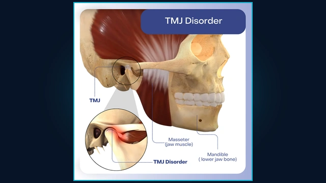 TMJ Joint Anatomy and Temporomandibular Disorder Diagnosis